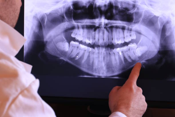 Teeth Whitening in VA