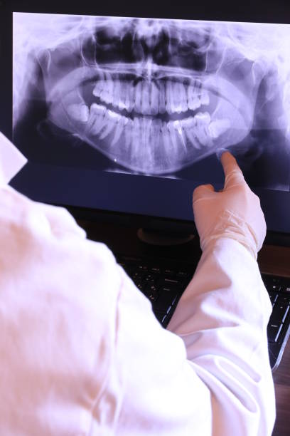 Best Chipped Tooth Repair Near Me  in Stuarts Draft, VA