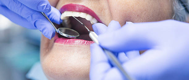 Best Dentist for Tooth Abscess  in Stuarts Draft, VA